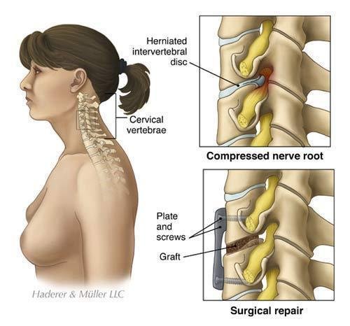 Dr. Alok Gadkari’s Spine Surgery Clinic offers world-class treatment with advanced surgical and non-surgical solutions.
