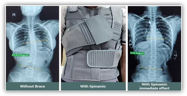 Dr. Alok Gadkari is a renowned spine specialist with years of experience in diagnosing and treating a wide range of spinal disorders.