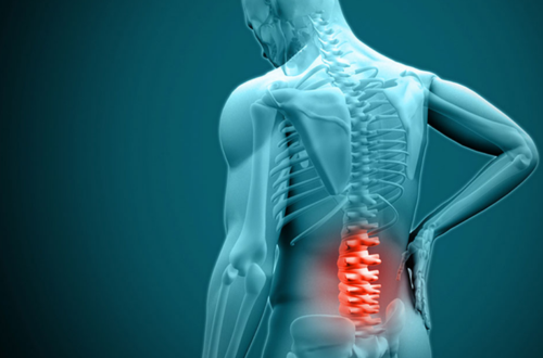 Lumbar Decompression